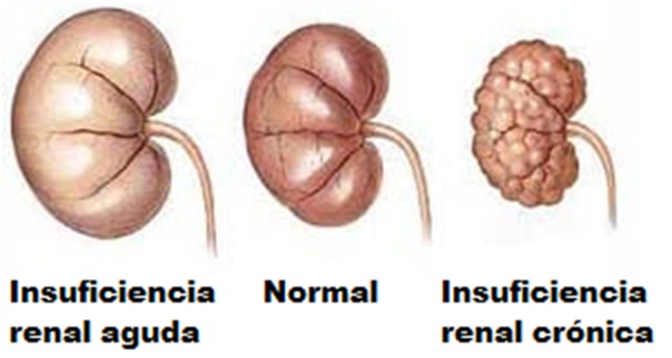 DOENÇA RENAL CRÔNICA | Hospital das Clínicas de Botucatu